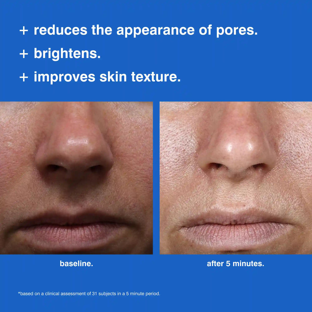 foaming reset mask.